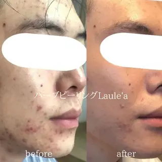 痩身/腸もみ/ ヘッドスパ/リンパのエステ・リラクイメージ