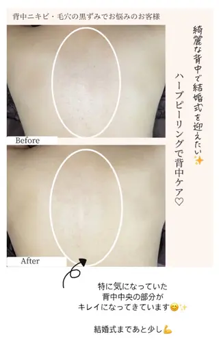 ベラージュ【美背中・ 美尻・フェイシャル】のエステ・リラクイメージ