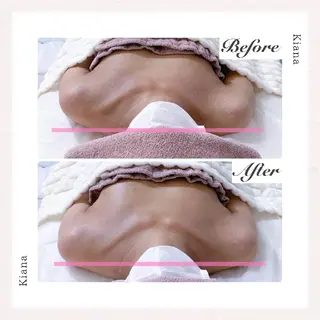 【バスト専門店 】 Kiana のエステ・リラクイメージ