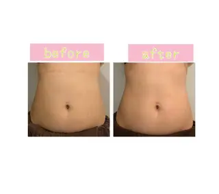 癒し腸もみサロン シャユーム　ゆきなのエステ・リラクイメージ