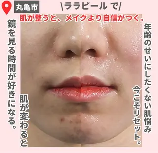 前山 くるみのエステ・リラクイメージ