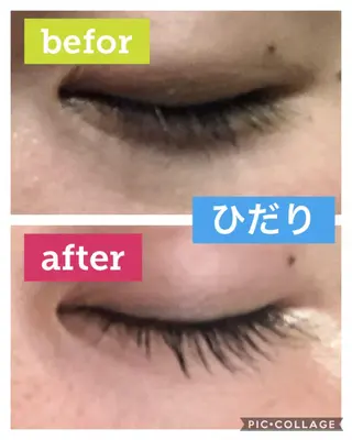 マツエク・マツパ ヒーリングサロン メリッサ/tooSMILE所属・大屋 詩織のエステ・リラクイメージ