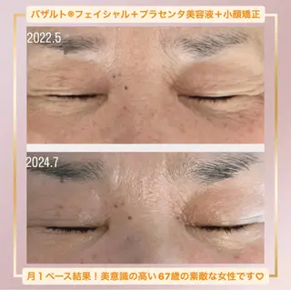 糸島 エステサロンmiuのエステ・リラクイメージ