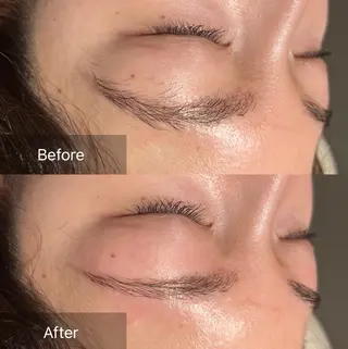 アイブロウ for woman所属・森 美優のエステ・リラクイメージ