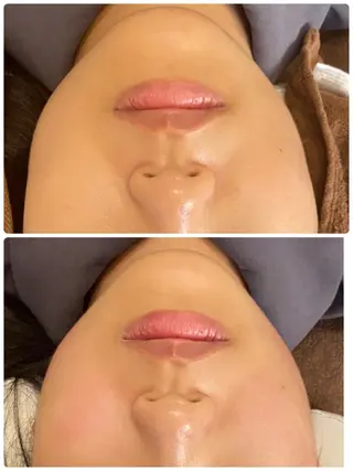 FLEUR大阪・整体 ・ハイフ・痩身・小顔のエステ・リラクイメージ