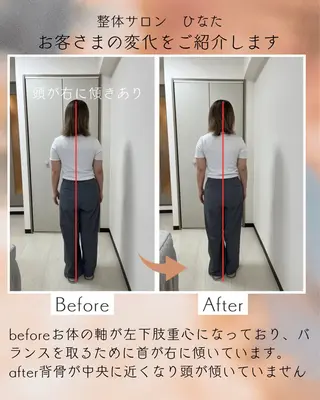 整体サロン　ひなた~HINATA~ 　京阪七条　京都店所属・肩こり反り腰改善専門 筋膜✨整体ひなたのエステ・リラクイメージ