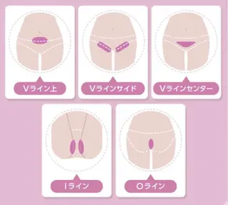 【天神・大名】脱毛/ ハーブ植松७९०のその他イメージ