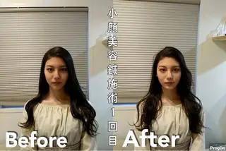 鍼灸整骨院Refine所属・鍼灸 Refineのその他イメージ