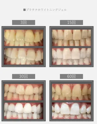 Monreve所属・美人スイッチdiet スーパージェクションのその他イメージ