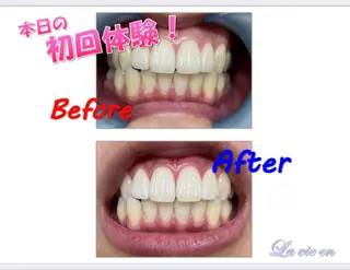 セルフホワイトニングサロン　ラヴィアン所属・ホワイトニングサロン La vie enのその他イメージ