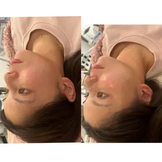 美容鍼灸サロン mahoroba院長のエステ・リラクイメージ