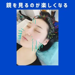 小顔美容鍼専門サロン 渋谷YZのエステ・リラクイメージ