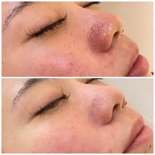 MiEL total beauty salon所属・トータルビューティ MiELのエステ・リラクイメージ