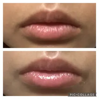 Kalama whitening salon所属・野村 杏南のその他イメージ
