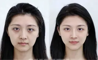 ショート aliaハイフ&水光ジェットサロン所属・aliaハーブ水光店 エステティシャン募集のエステ・リラクイメージ