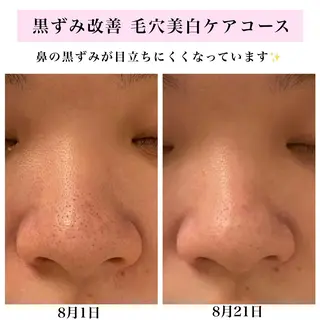 Bellesthe (ベルエステ)のエステ・リラクイメージ