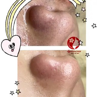 ニキビ、痩身、脱毛、 サクラチャンスパのエステ・リラクイメージ