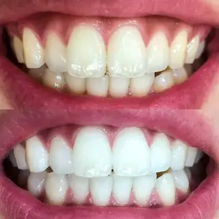 Luana武蔵小杉店 (ルアナ)のエステ・リラクイメージ