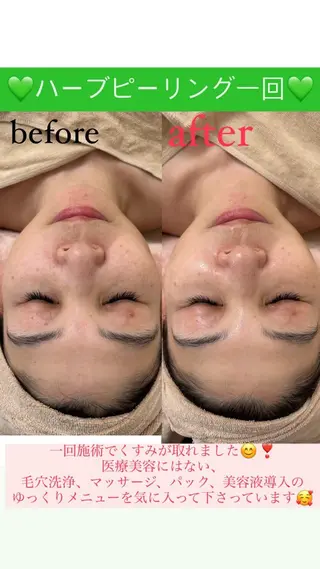 メンズ Salon de Lino 御器所のエステ・リラクイメージ