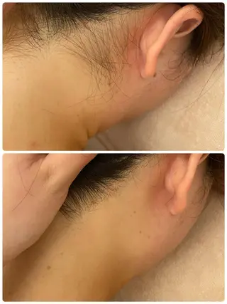 ✨美肌水光✨ アトリエリュバンのエステ・リラクイメージ