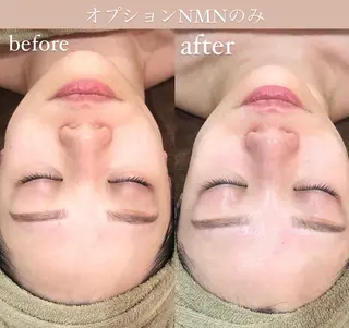 NiU.BEAUTY 新宿のエステ・リラクイメージ