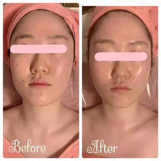 透明感の肌Lino malieのエステ・リラクイメージ