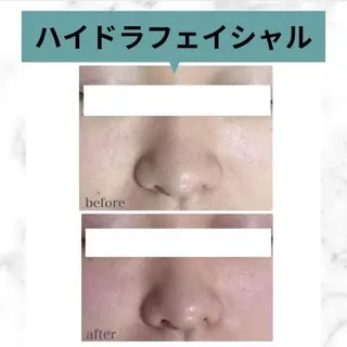 トータルビューティー addissimoのエステ・リラクイメージ