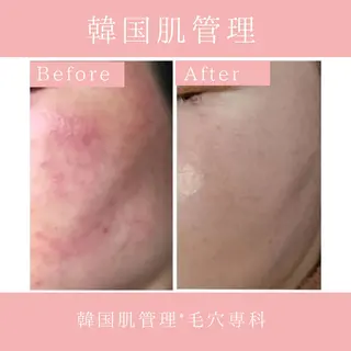 韓国肌管理 【毛穴専科】のエステ・リラクイメージ