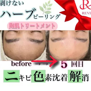 laluna saki...のその他イメージ