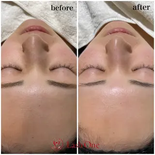 Lashone所属・Lash  One 四条店のエステ・リラクイメージ
