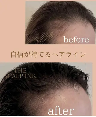 W eye+東口店/ SCALP INKのマツエク・マツパデザイン
