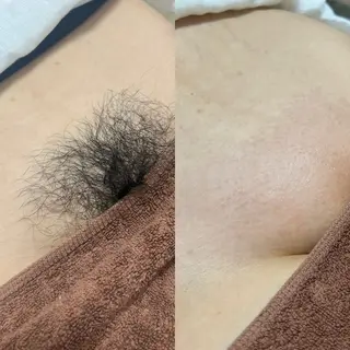 脱毛サロンBloom所属・脱毛屋さん/池袋 /Bloom🍋わだのエステ・リラクイメージ