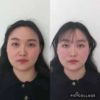 セミロング 小顔矯正/美容整体 /骨盤矯正✨+Mi2のエステ・リラクイメージ