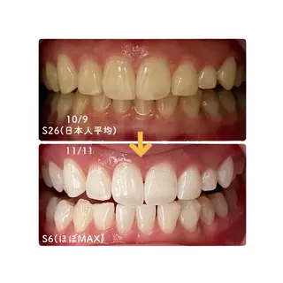 歯のセルフホワイトニング専門店GLOW（グロウ）所属・東区香椎歯のセルフホ ワイトニングGLOWのその他イメージ