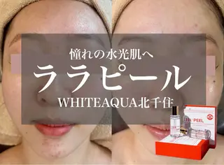 WHITE AQUA 北千住店のエステ・リラクイメージ