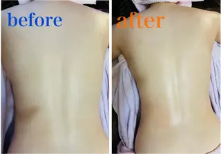 アロマ･美容鍼･カッ ピング「麗」鍼灸院のエステ・リラクイメージ