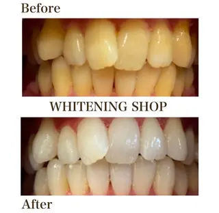 ホワイトニングショップ伊丹店所属・ホワイトニング ショップ伊丹店のその他イメージ