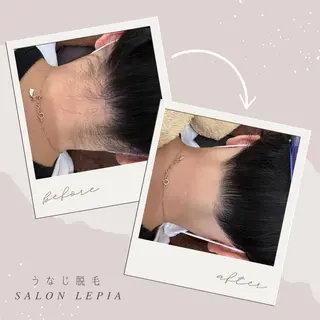 20代から始める脱毛 salonLEPIAのエステ・リラクイメージ