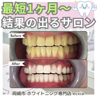 セルフホワイトニング エクシア岡崎店所属・ホワイトニング/脱毛 専門店エクシア岡崎店のその他イメージ