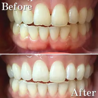 ロング ヘアアレンジ メンズ カラー パーマ ネイル アイブロウ マツエク・マツパ LBSホワイトニング 銀座店💎店長浦和のその他イメージ