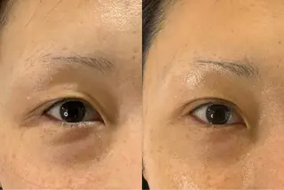 最速小顔・肌質管理 ❣️エスポワールのエステ・リラクイメージ