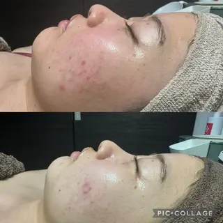 エステ✖️ネイル Feelのエステ・リラクイメージ