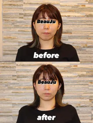 美容鍼灸整体サロンBeauJu所属・小顔矯/美容鍼/鍼灸 BeauJuのその他イメージ