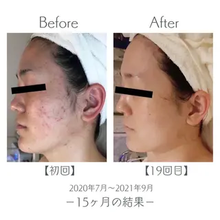 エステ＆美肌脱毛 ココサロ倉敷店のエステ・リラクイメージ