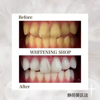 ホワイトニングショップ静岡葵区店所属・ホワイトニング ショップ静岡葵区店のその他イメージ