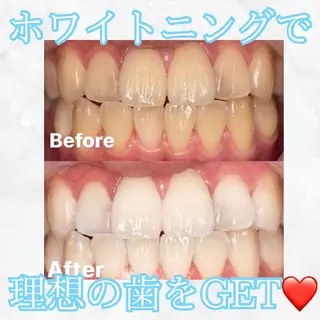 ホワイトニングサロン WHITE福岡博多店のエステ・リラクイメージ