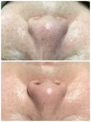 🔰 新米ネイリストのネイルデザイン