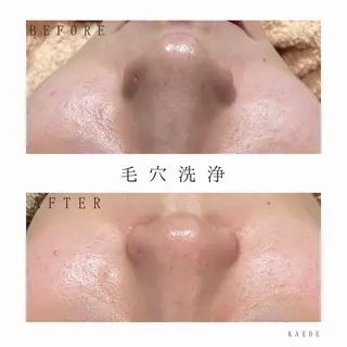 🎀kaede🎀 骨格似合わせ眉毛の眉毛・アイブロウイメージ