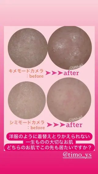 ＲＩＯＮ 〜リオン〜 ／    肌育サロンのエステ・リラクイメージ