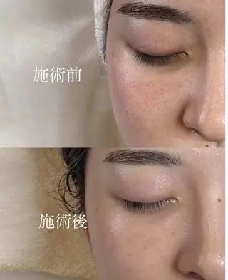 NAZ eyelash&eyebrow by medical salon所属・NAZ 表参道 Tomokoのマツエク・マツパデザイン